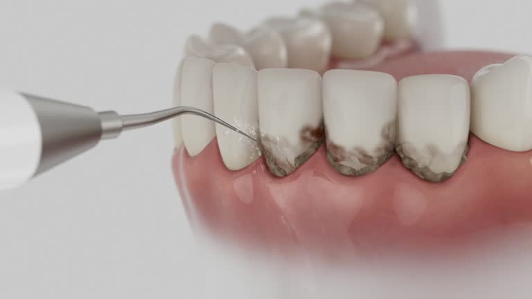 Trusted Teeth Cleaning And Checkup service in Plum, PA - Dentist Open Now